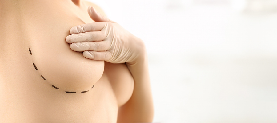 breast-reduction-surgery